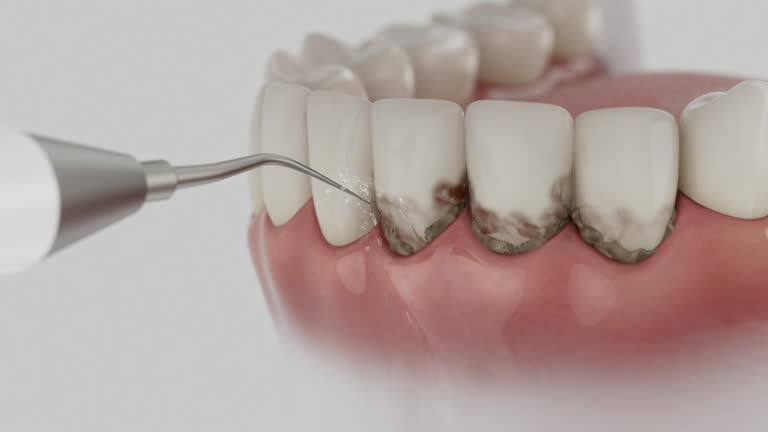 Trusted Teeth Cleaning And Checkup service in Northport, NY - Dentist Open Now